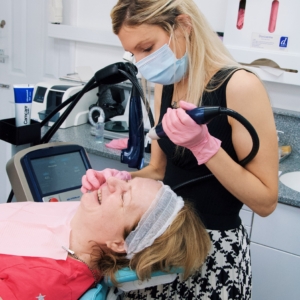 Ultracel Skin Tightening | Thames Dental & Facial Care | Surrey, UK