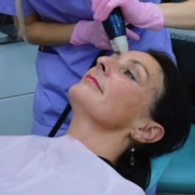 Hi Fu Treatment | Thames Dental & Facial Care | Surrey, UK